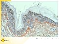 Electron microscopy and Immuno-gold reagents