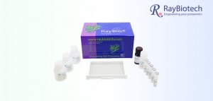 Économisez 25 % sur tous les kits ELISA de RayBiotech